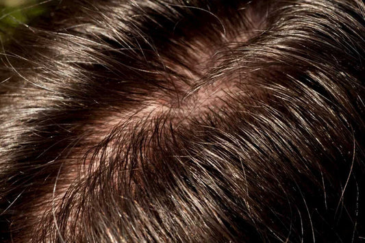Do You Suffer From Oily Hair or an Oily Scalp? Our Advice.