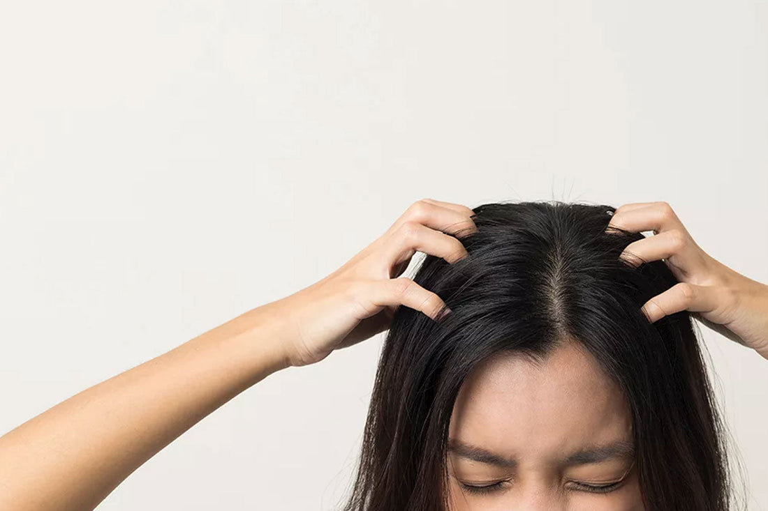 Tips and Solutions for an Itchy, Irritated, and Sensitive Scalp